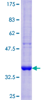 SMPD1 / Acid Sphingomyelinase Protein - 12.5% SDS-PAGE Stained with Coomassie Blue.