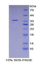 SMPD1 / Acid Sphingomyelinase Protein - Recombinant Acid Sphingomyelinase By SDS-PAGE