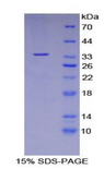 SMPD1 / Acid Sphingomyelinase Protein - Recombinant Acid Sphingomyelinase By SDS-PAGE