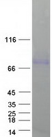 SMPD1 / Acid Sphingomyelinase Protein - Purified recombinant protein SMPD1 was analyzed by SDS-PAGE gel and Coomassie Blue Staining