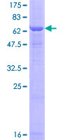 SMPD2 Protein - 12.5% SDS-PAGE of human SMPD2 stained with Coomassie Blue