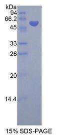 SMPD2 Protein - Recombinant Neutral Sphingomyelinase By SDS-PAGE