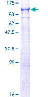 SMPD3 / NSMASE2 Protein - 12.5% SDS-PAGE of human SMPD3 stained with Coomassie Blue