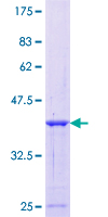 SMPD3 / NSMASE2 Protein - 12.5% SDS-PAGE Stained with Coomassie Blue.