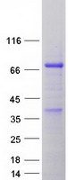 SMPD3 / NSMASE2 Protein - Purified recombinant protein SMPD3 was analyzed by SDS-PAGE gel and Coomassie Blue Staining