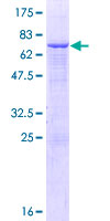 SMPDL3A Protein - 12.5% SDS-PAGE of human SMPDL3A stained with Coomassie Blue
