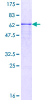 SMPDL3B Protein - 12.5% SDS-PAGE of human SMPDL3B stained with Coomassie Blue