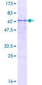 SMPDL3B Protein - 12.5% SDS-PAGE of human SMPDL3B stained with Coomassie Blue