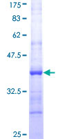 SMPDL3B Protein - 12.5% SDS-PAGE Stained with Coomassie Blue.