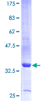 SMR3B Protein - 12.5% SDS-PAGE of human SMR3B stained with Coomassie Blue