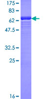 SMS / Spermine Synthase Protein - 12.5% SDS-PAGE of human SMS stained with Coomassie Blue