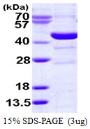 SMS / Spermine Synthase Protein