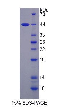 SMS / Spermine Synthase Protein - Recombinant Spermine Synthase (SMS) by SDS-PAGE