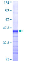 SMS2 / SGMS2 Protein - 12.5% SDS-PAGE Stained with Coomassie Blue.