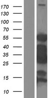 SMTNL2 Protein - Western validation with an anti-DDK antibody * L: Control HEK293 lysate R: Over-expression lysate