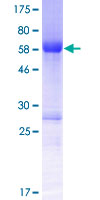 SMTNL2 Protein - 12.5% SDS-PAGE of human SMTNL2 stained with Coomassie Blue