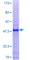 SMUG1 Protein - 12.5% SDS-PAGE of human SMUG1 stained with Coomassie Blue