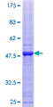 SMUG1 Protein - 12.5% SDS-PAGE of human SMUG1 stained with Coomassie Blue