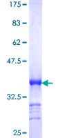 SMUG1 Protein - 12.5% SDS-PAGE Stained with Coomassie Blue.
