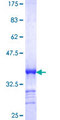 SMUG1 Protein - 12.5% SDS-PAGE Stained with Coomassie Blue.