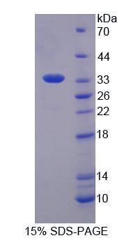 SMUG1 Protein - Recombinant Single Strand Selective Monofunctional Uracil DNA Glycosylase 1 By SDS-PAGE