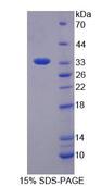 SMUG1 Protein - Recombinant Single Strand Selective Monofunctional Uracil DNA Glycosylase 1 By SDS-PAGE