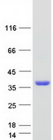 SMUG1 Protein - Purified recombinant protein SMUG1 was analyzed by SDS-PAGE gel and Coomassie Blue Staining