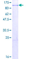 SMURF1 Protein - 12.5% SDS-PAGE of human SMURF1 stained with Coomassie Blue