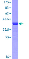 SMURF1 Protein - 12.5% SDS-PAGE Stained with Coomassie Blue.