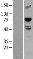 SMURF2 Protein - Western validation with an anti-DDK antibody * L: Control HEK293 lysate R: Over-expression lysate