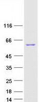 SMYD1 Protein - Purified recombinant protein SMYD1 was analyzed by SDS-PAGE gel and Coomassie Blue Staining