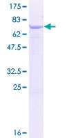 SMYD2 Protein - 12.5% SDS-PAGE of human SMYD2 stained with Coomassie Blue