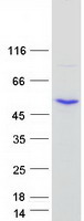 SMYD2 Protein - Purified recombinant protein SMYD2 was analyzed by SDS-PAGE gel and Coomassie Blue Staining