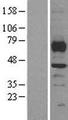 SMYD3 Protein - Western validation with an anti-DDK antibody * L: Control HEK293 lysate R: Over-expression lysate