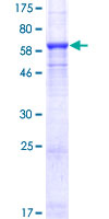 SMYD3 Protein - 12.5% SDS-PAGE of human SMYD3 stained with Coomassie Blue