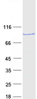 SMYD4 Protein - Purified recombinant protein SMYD4 was analyzed by SDS-PAGE gel and Coomassie Blue Staining