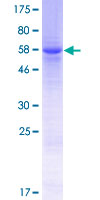 SMYD5 Protein - 12.5% SDS-PAGE of human SMYD5 stained with Coomassie Blue