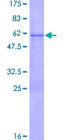 SNAI1 / SNAIL-1 Protein - 12.5% SDS-PAGE of human SNAI1 stained with Coomassie Blue