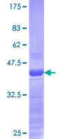 SNAI1 / SNAIL-1 Protein - 12.5% SDS-PAGE Stained with Coomassie Blue.