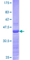 SNAI1 / SNAIL-1 Protein - 12.5% SDS-PAGE Stained with Coomassie Blue.