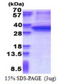 SNAI1 / SNAIL-1 Protein