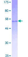 SNAI2 / SLUG Protein - 12.5% SDS-PAGE of human SNAI2 stained with Coomassie Blue