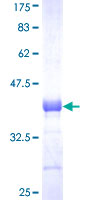 SNAI2 / SLUG Protein - 12.5% SDS-PAGE Stained with Coomassie Blue.