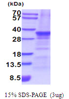 SNAI2 / SLUG Protein