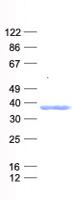 SNAI2 / SLUG Protein