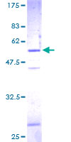 SNAP23 / SNAP-23 Protein - 12.5% SDS-PAGE of human SNAP23 stained with Coomassie Blue