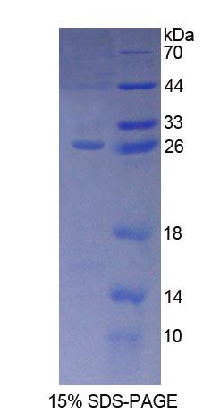 SNAP23 / SNAP-23 Protein - Recombinant  Synaptosomal Associated Protein 23kDa By SDS-PAGE