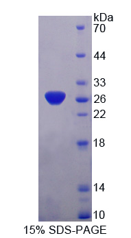 SNAP25 Protein - Recombinant  Synaptosomal Associated Protein 25kDa By SDS-PAGE