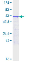 SNAP29 Protein - 12.5% SDS-PAGE of human SNAP29 stained with Coomassie Blue