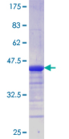 SNAP29 Protein - 12.5% SDS-PAGE Stained with Coomassie Blue.